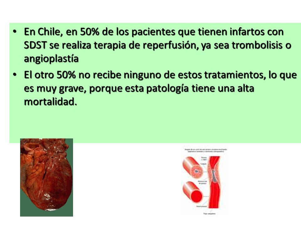 En Chile, en 50% de los pacientes que tienen infartos con SDST se realiza terapia de reperfusión, ya sea trombolisis o angioplastía
