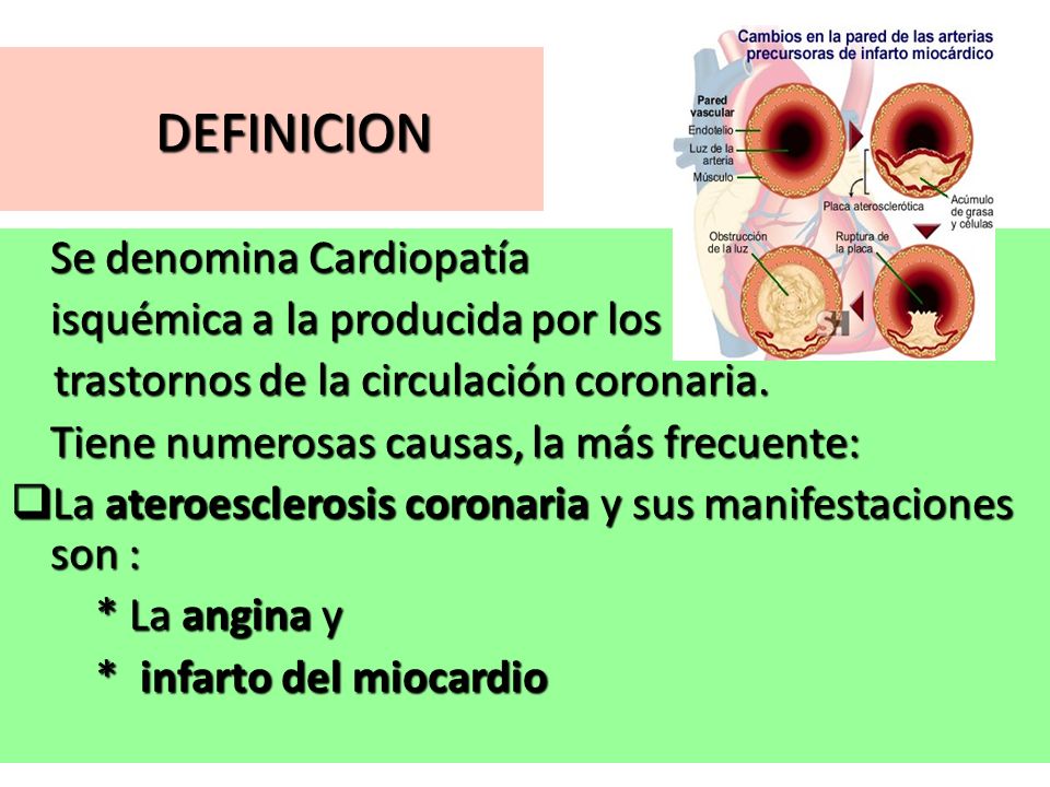DEFINICION Se denomina Cardiopatía isquémica a la producida por los
