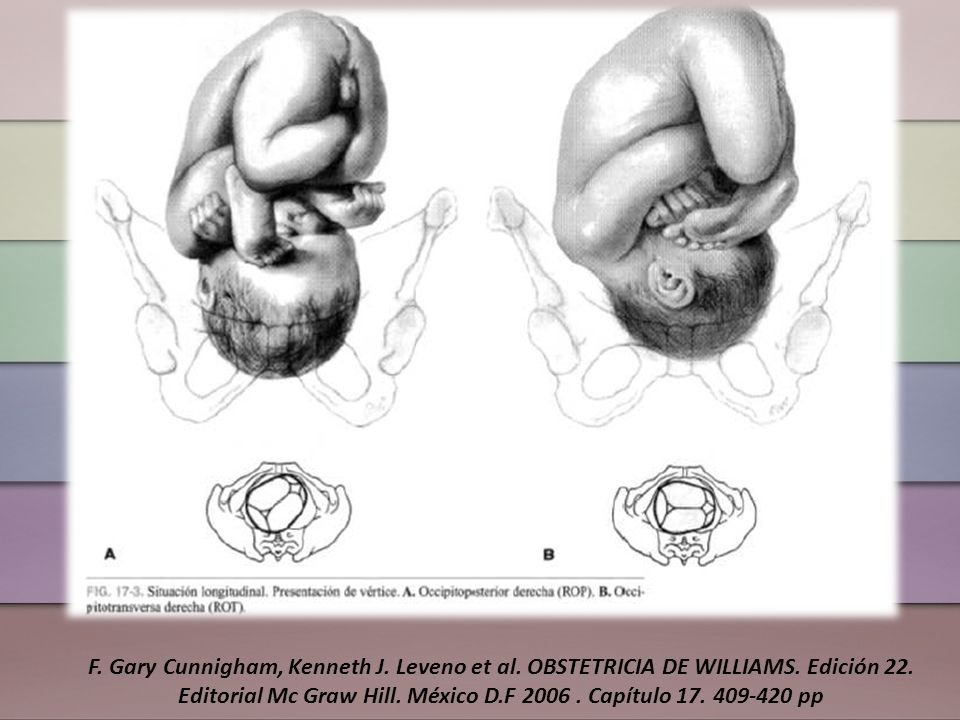 F. Gary Cunnigham, Kenneth J. Leveno et al. OBSTETRICIA DE WILLIAMS