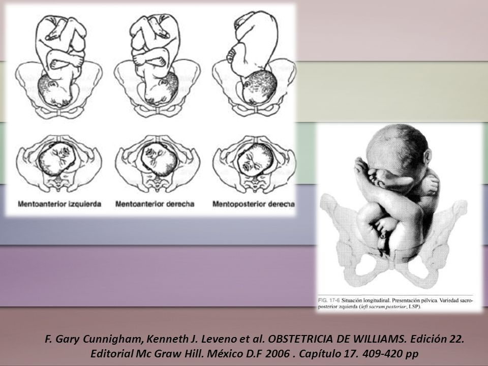 F. Gary Cunnigham, Kenneth J. Leveno et al. OBSTETRICIA DE WILLIAMS