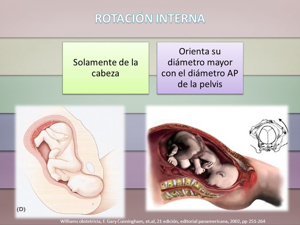 Orienta su diámetro mayor con el diámetro AP de la pelvis