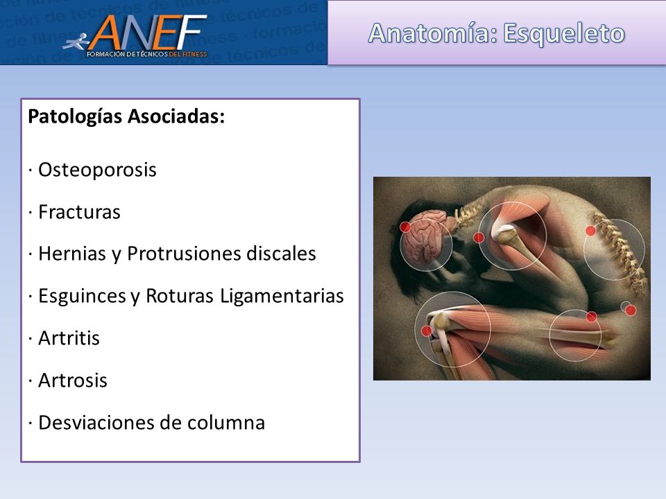 Anatomía: Esqueleto Patologías Asociadas: · Osteoporosis · Fracturas