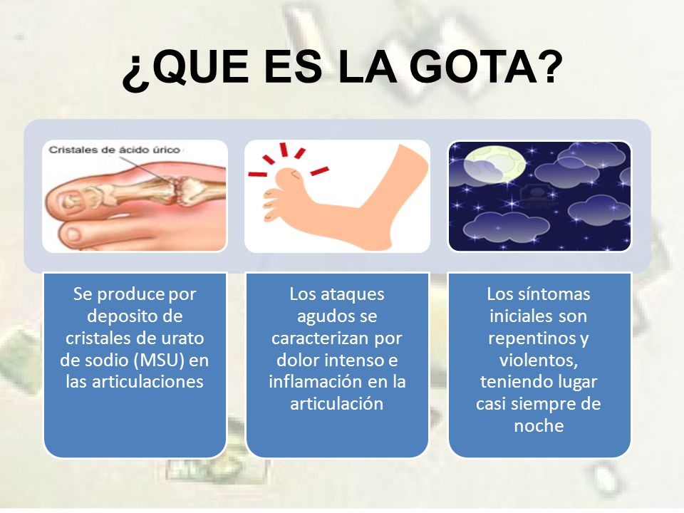 ¿QUE ES LA GOTA Se produce por deposito de cristales de urato de sodio (MSU) en las articulaciones.