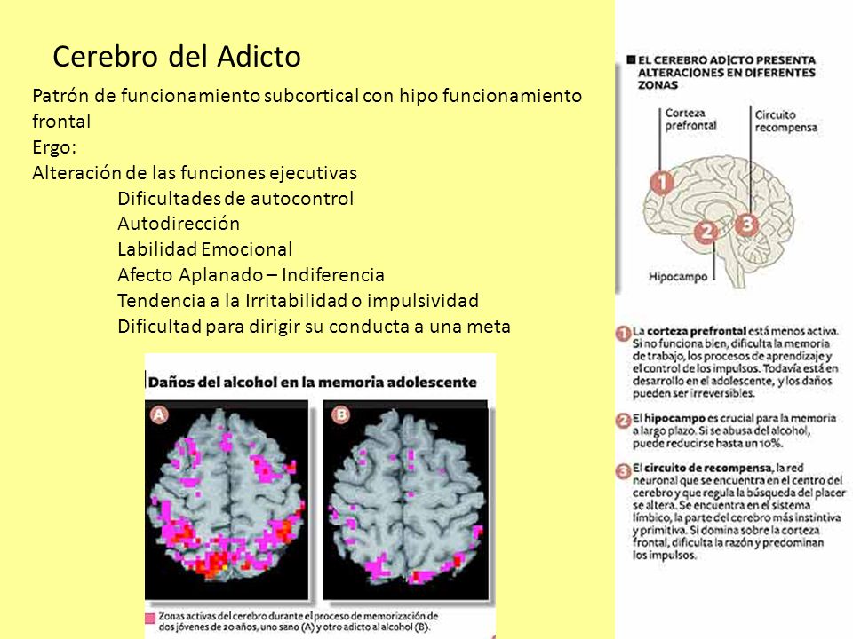 Cerebro del Adicto Patrón de funcionamiento subcortical con hipo funcionamiento frontal. Ergo: Alteración de las funciones ejecutivas.
