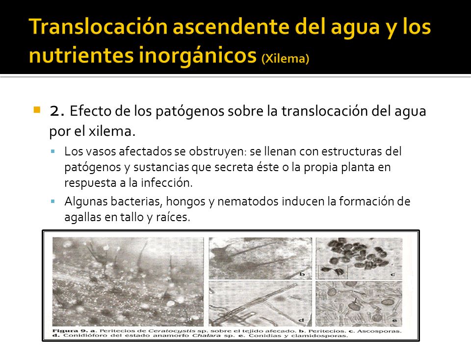 Translocación ascendente del agua y los nutrientes inorgánicos (Xilema)