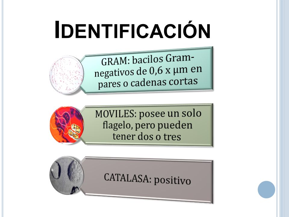 Identificación GRAM: bacilos Gram-negativos de 0,6 x µm en pares o cadenas cortas. MOVILES: posee un solo flagelo, pero pueden tener dos o tres.