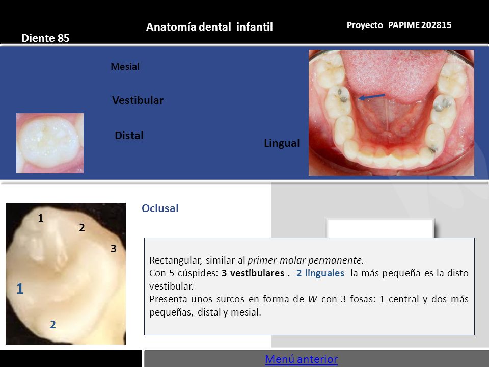 1 Anatomía dental infantil Diente 85 Vestibular Distal Lingual Oclusal