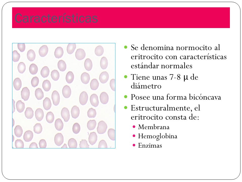 Características Se denomina normocito al eritrocito con características estándar normales. Tiene unas 7-8 μ de diámetro.