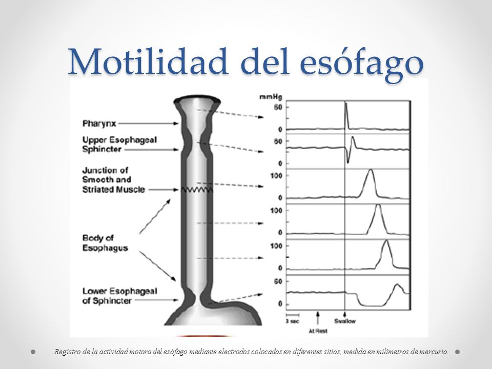 Motilidad del esófago Registro de la actividad motora del esófago a través de electrodos.