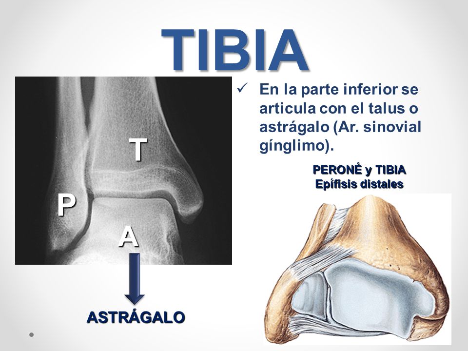 TIBIA En la parte inferior se articula con el talus o astrágalo (Ar. sinovial gínglimo). T. PERONÉ y TIBIA.