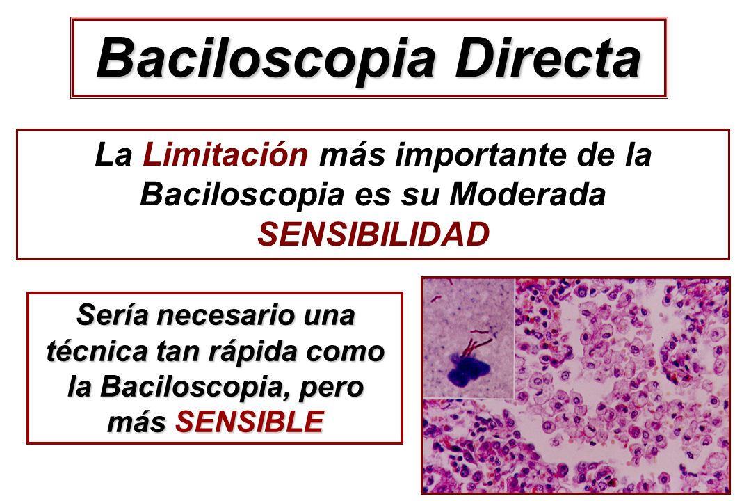 Baciloscopia Directa La Limitación más importante de la Baciloscopia es su Moderada SENSIBILIDAD.
