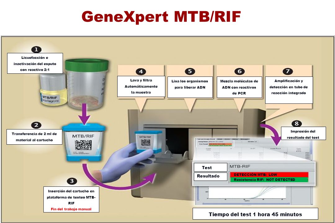 GeneXpert MTB/RIF Test Tiempo del test 1 hora 45 minutos 22 Resultado