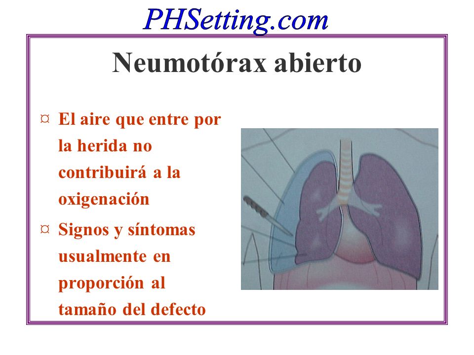Neumotórax abierto El aire que entre por la herida no contribuirá a la oxigenación.