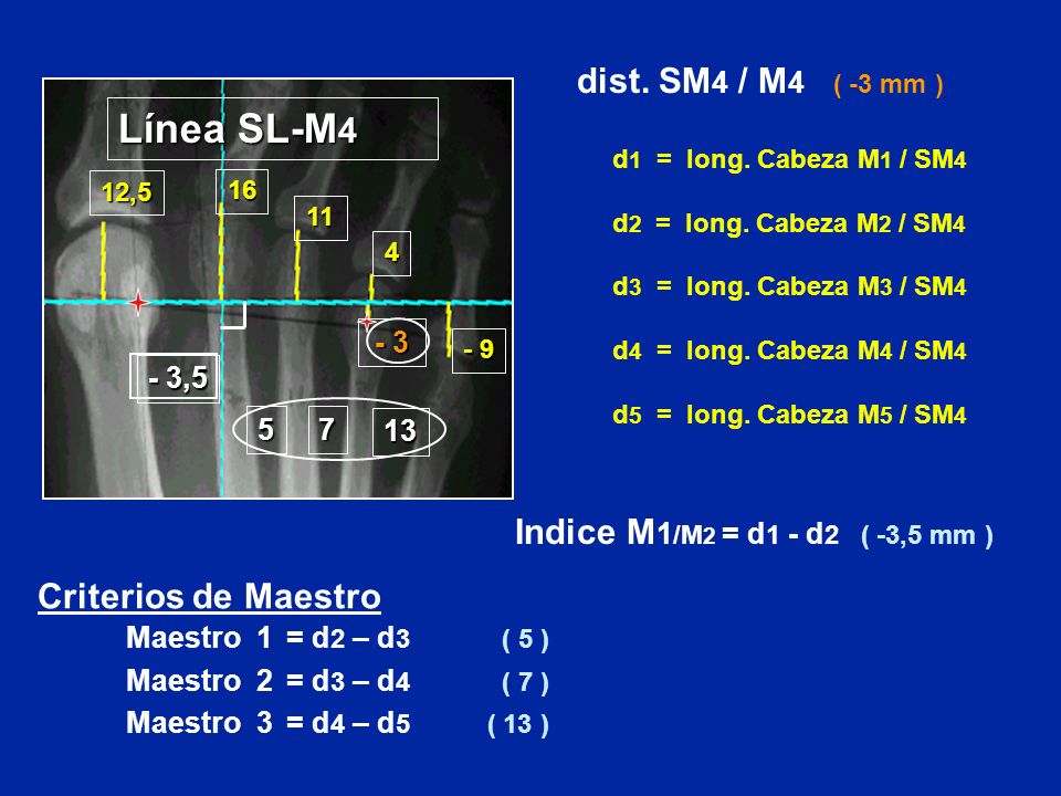 Línea SL-M4 dist. SM4 / M4 ( -3 mm )