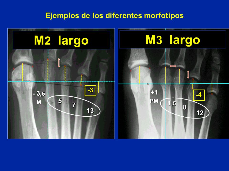 Ejemplos de los diferentes morfotipos