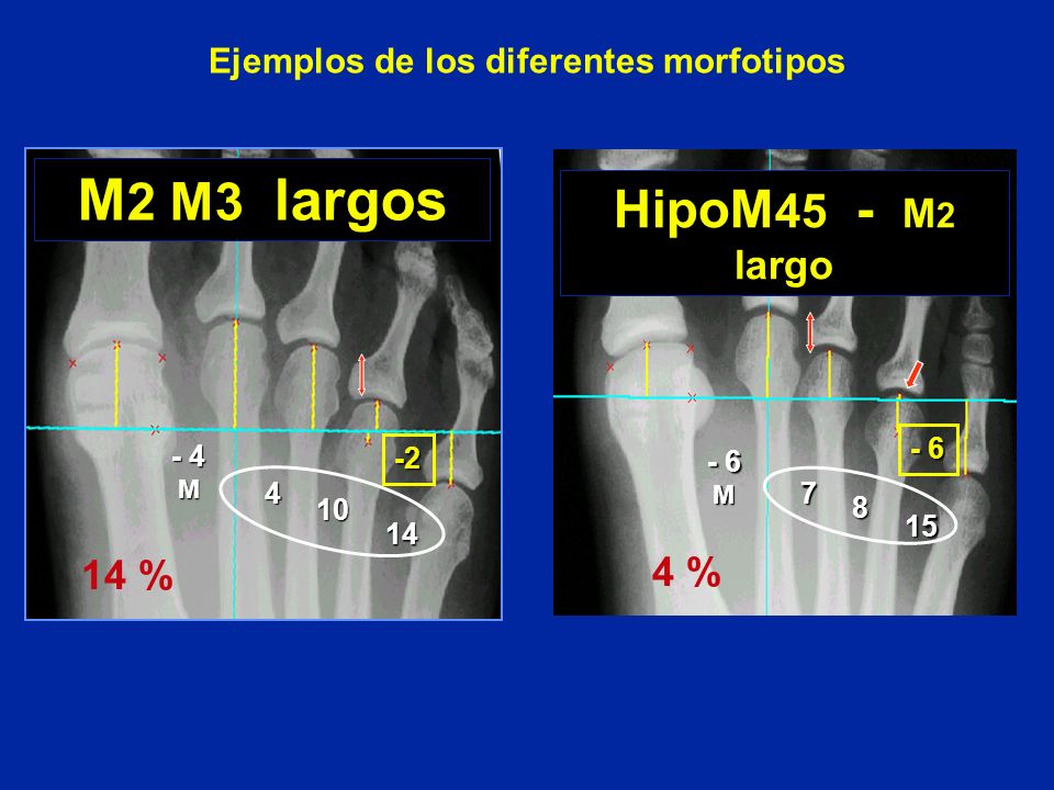 Ejemplos de los diferentes morfotipos