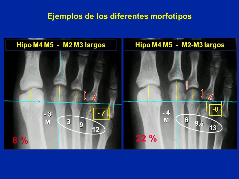 Ejemplos de los diferentes morfotipos