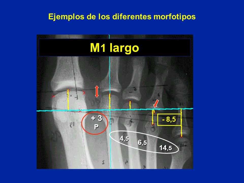 Ejemplos de los diferentes morfotipos