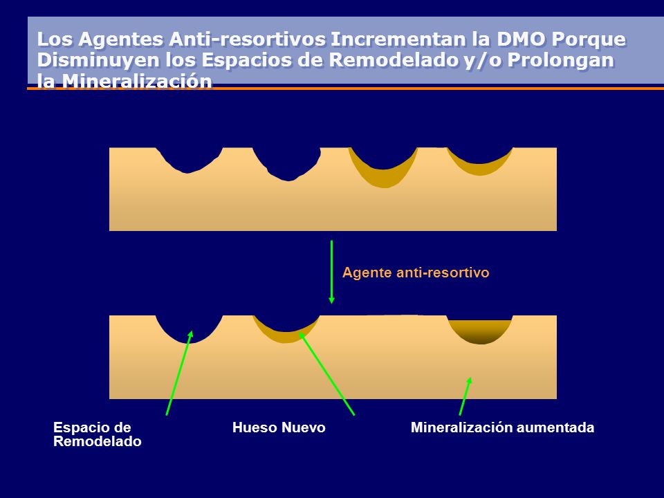 Los Agentes Anti-resortivos Incrementan la DMO Porque Disminuyen los Espacios de Remodelado y/o Prolongan la Mineralización
