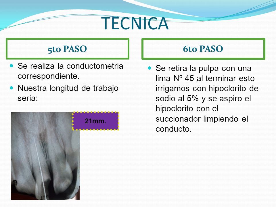 TECNICA 5to PASO. 6to PASO. Se realiza la conductometria correspondiente. Nuestra longitud de trabajo seria: