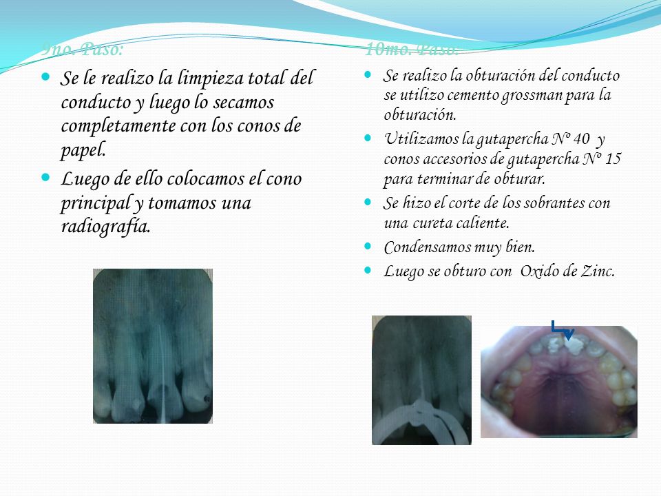 Luego de ello colocamos el cono principal y tomamos una radiografía.