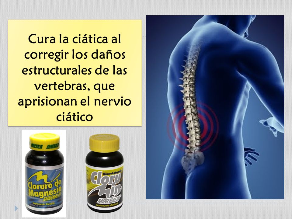 Cura la ciática al corregir los daños estructurales de las vertebras, que aprisionan el nervio ciático