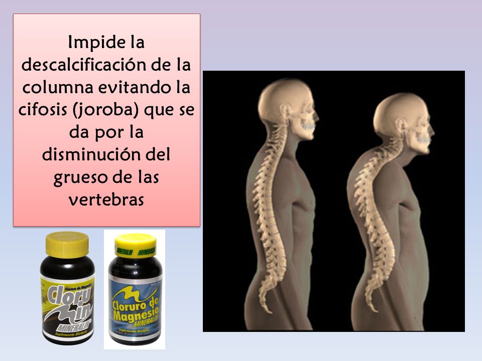 Impide la descalcificación de la columna evitando la cifosis (joroba) que se da por la disminución del grueso de las vertebras