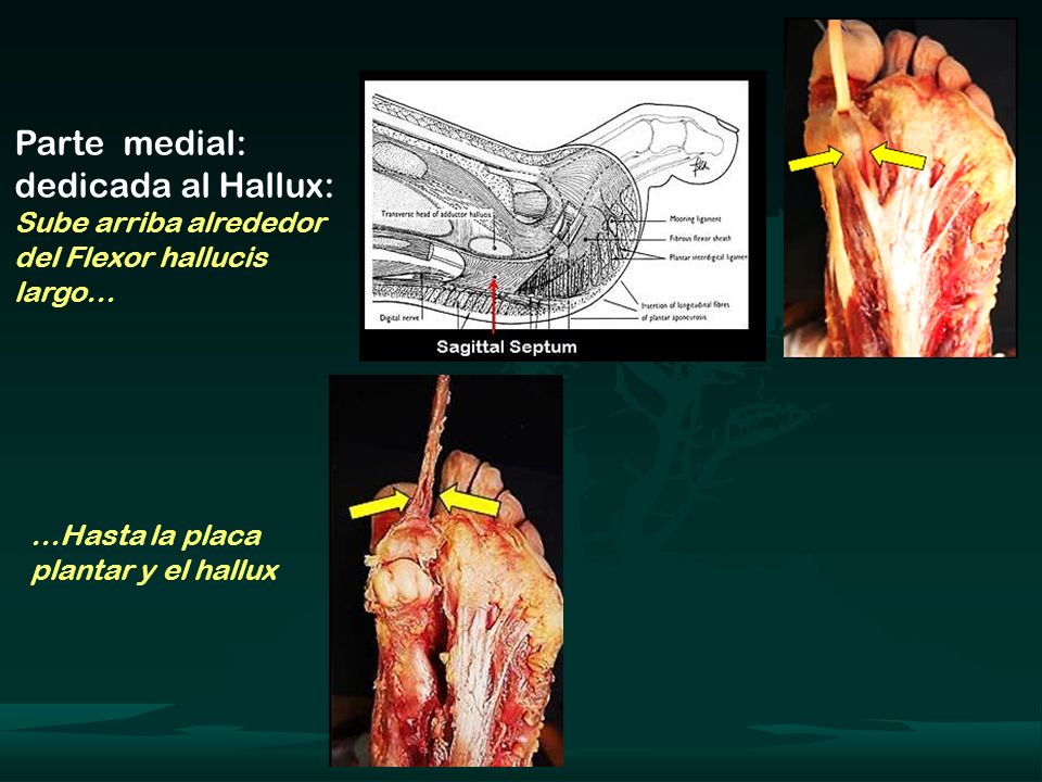 Parte medial: dedicada al Hallux: Sube arriba alrededor del Flexor hallucis largo…