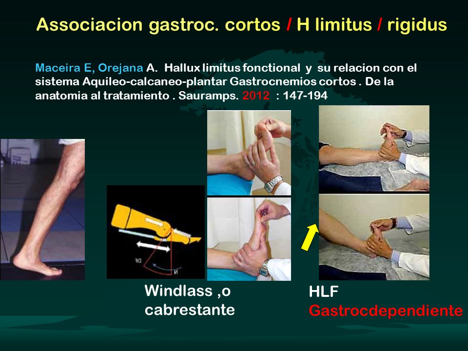 Associacion gastroc. cortos / H limitus / rigidus