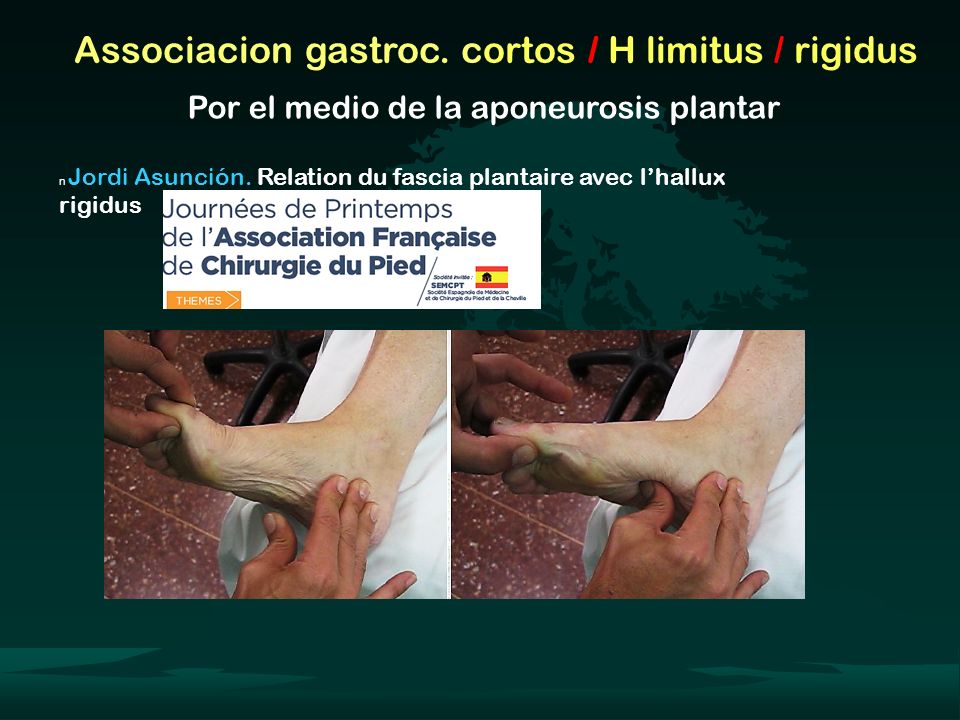 Associacion gastroc. cortos / H limitus / rigidus