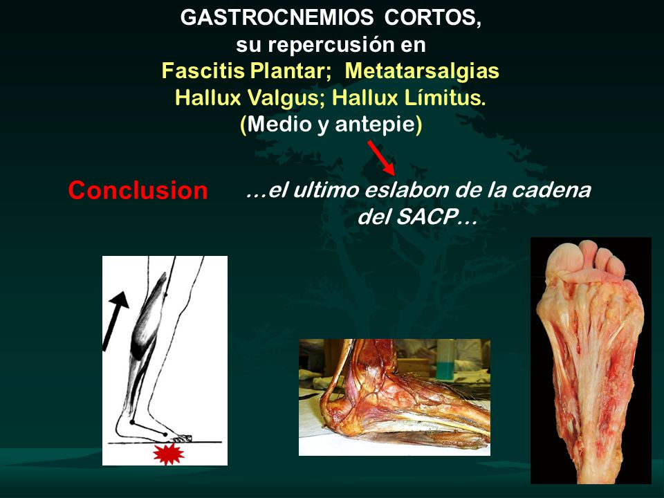 …el ultimo eslabon de la cadena del SACP…