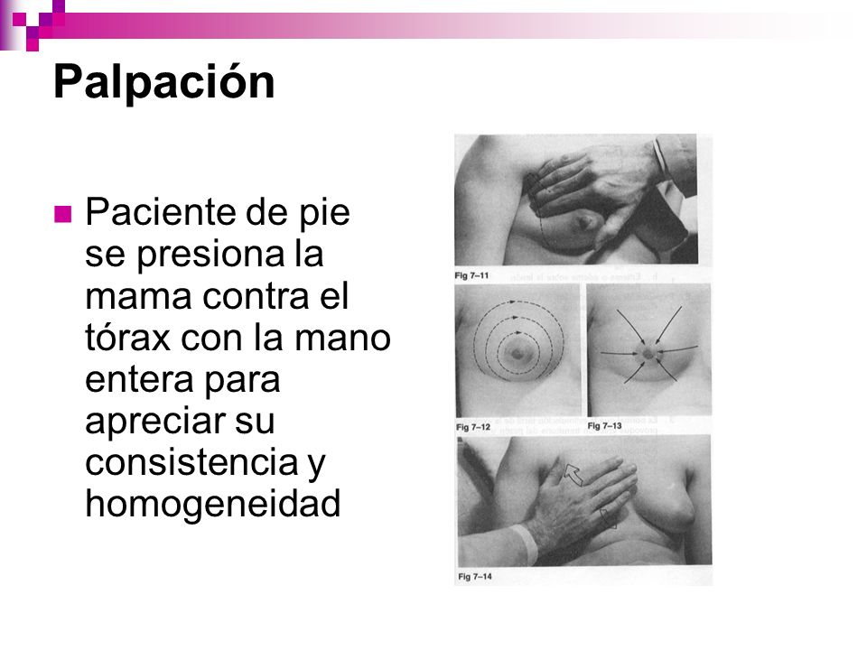 Palpación Paciente de pie se presiona la mama contra el tórax con la mano entera para apreciar su consistencia y homogeneidad.