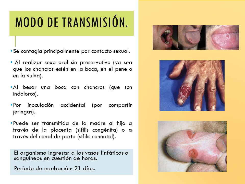 Modo de transmisión. Se contagia principalmente por contacto sexual.