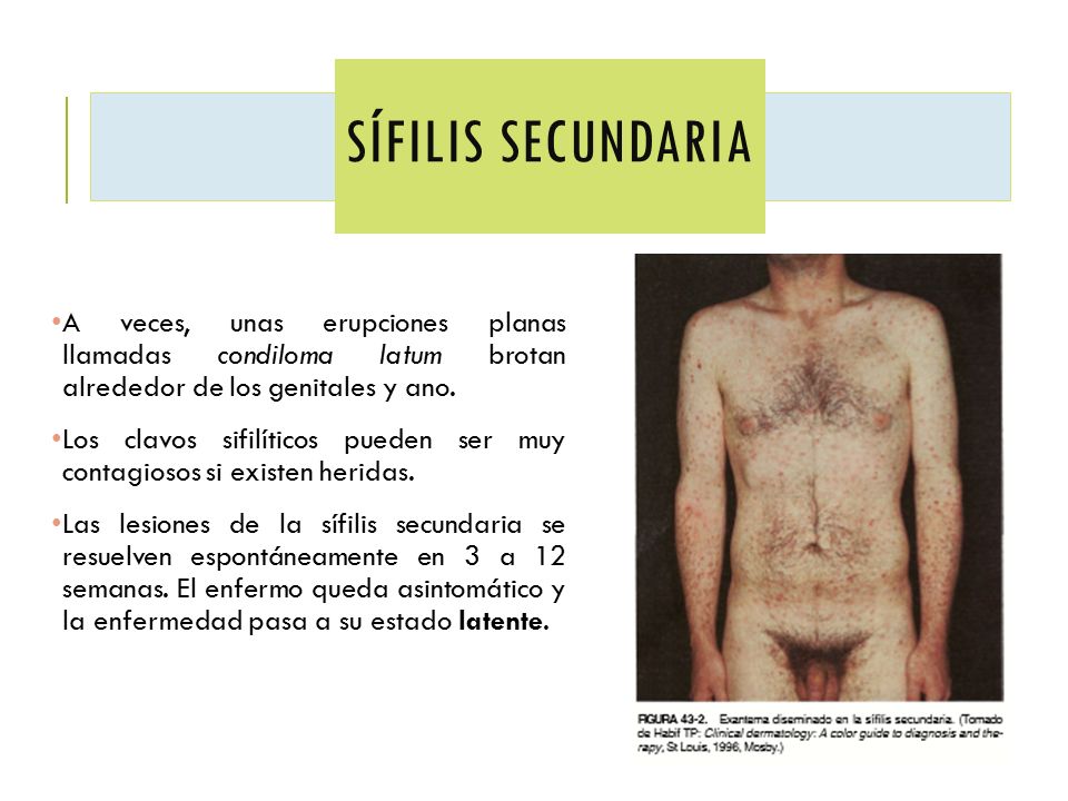 Sífilis secundaria A veces, unas erupciones planas llamadas condiloma latum brotan alrededor de los genitales y ano.