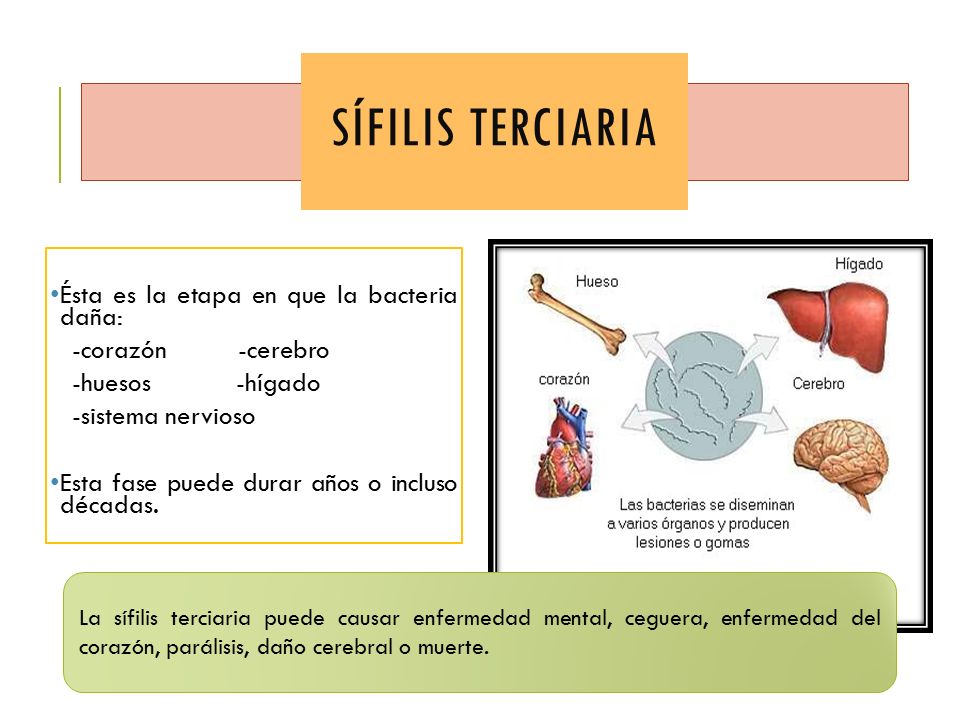 Sífilis terciaria Ésta es la etapa en que la bacteria daña: