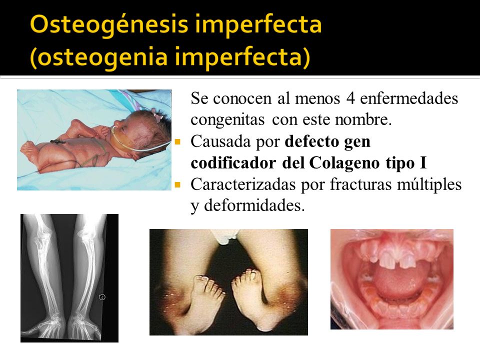Se conocen al menos 4 enfermedades congenitas con este nombre.