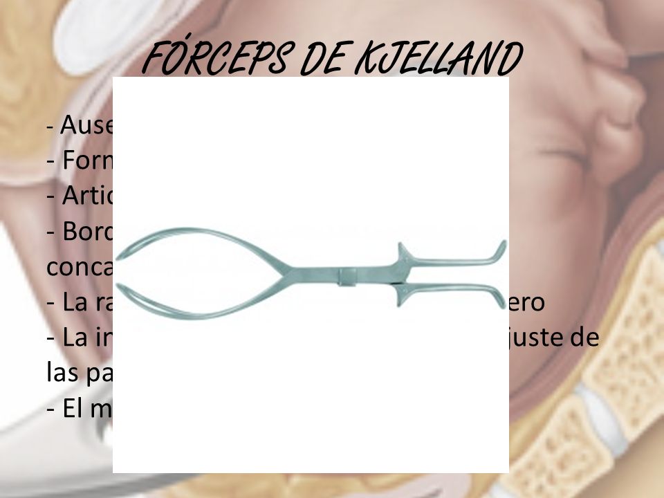 FÓRCEPS DE KJELLAND Forma de bayoneta Articulación deslizable