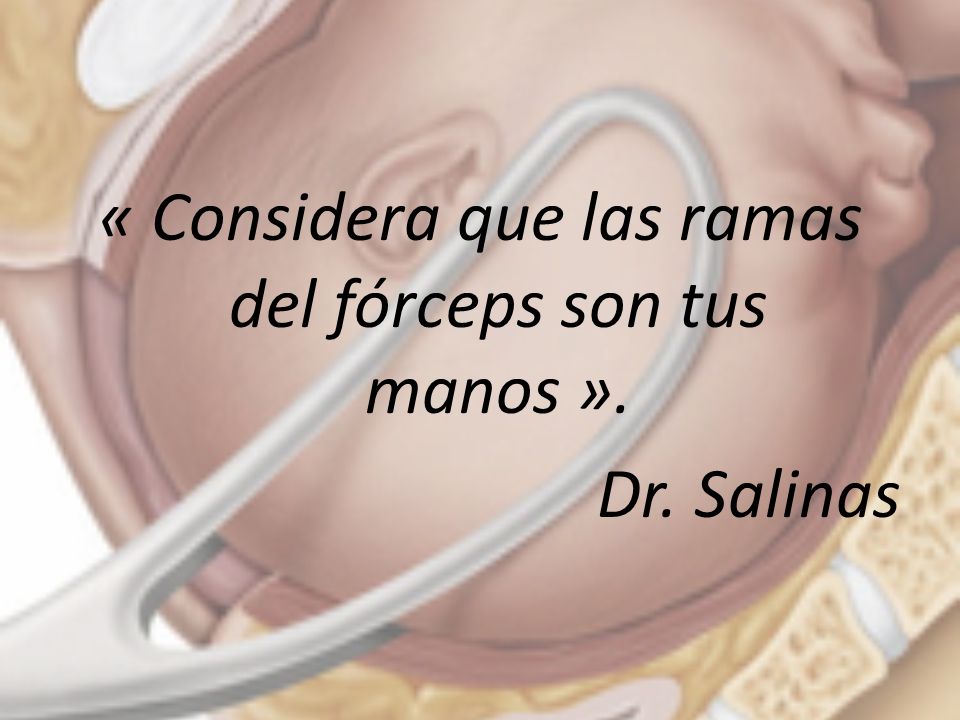 « Considera que las ramas del fórceps son tus manos ». Dr. Salinas