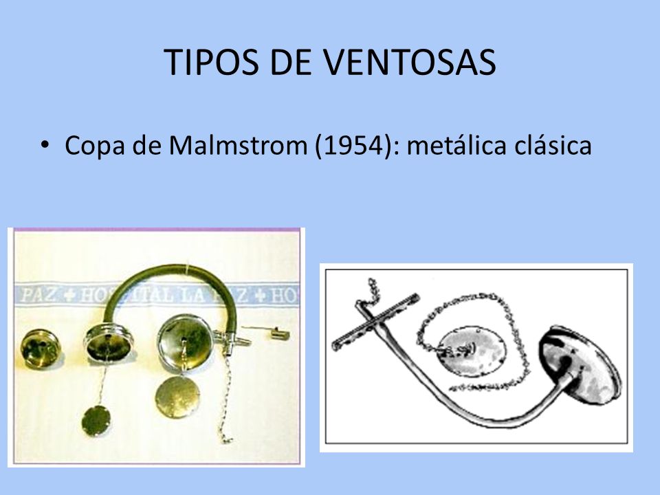 TIPOS DE VENTOSAS Copa de Malmstrom (1954): metálica clásica