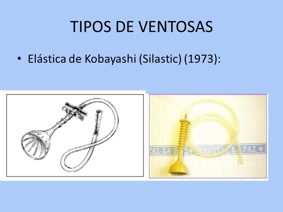 TIPOS DE VENTOSAS Elástica de Kobayashi (Silastic) (1973):