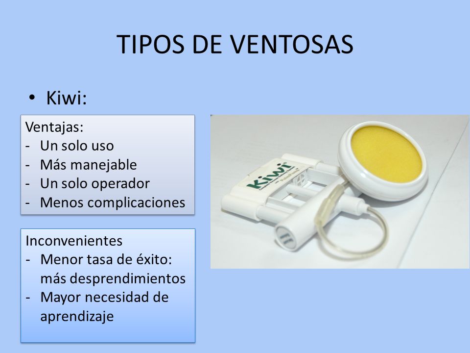 TIPOS DE VENTOSAS Kiwi: Ventajas: Un solo uso Más manejable