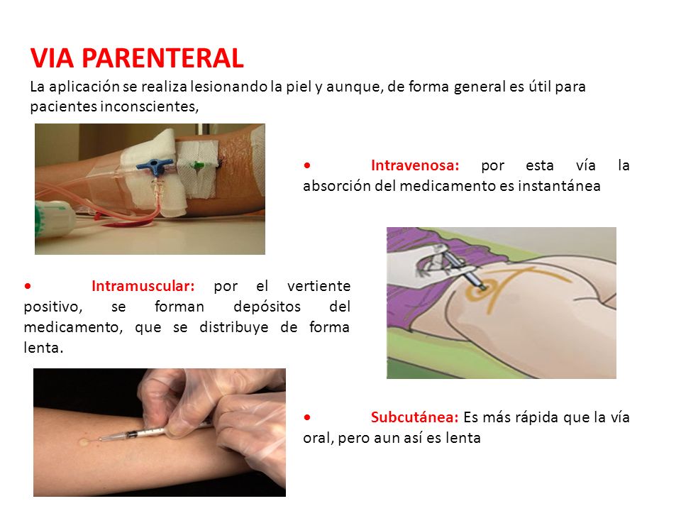 VIA PARENTERAL La aplicación se realiza lesionando la piel y aunque, de forma general es útil para pacientes inconscientes,