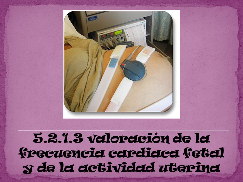 valoración de la frecuencia cardiaca fetal y de la actividad uterina