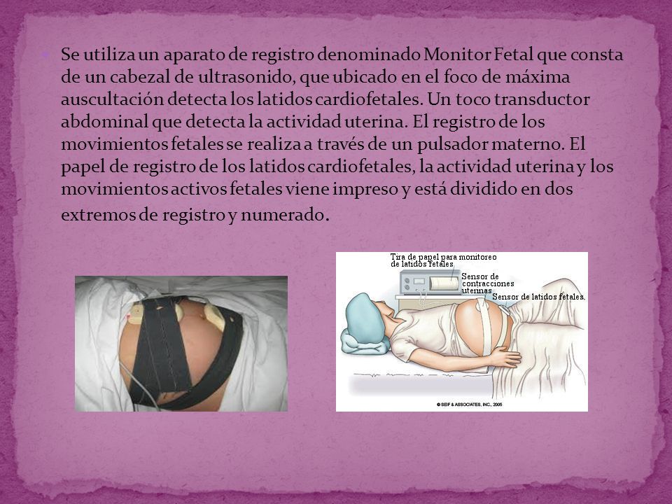 Se utiliza un aparato de registro denominado Monitor Fetal que consta de un cabezal de ultrasonido, que ubicado en el foco de máxima auscultación detecta los latidos cardiofetales.