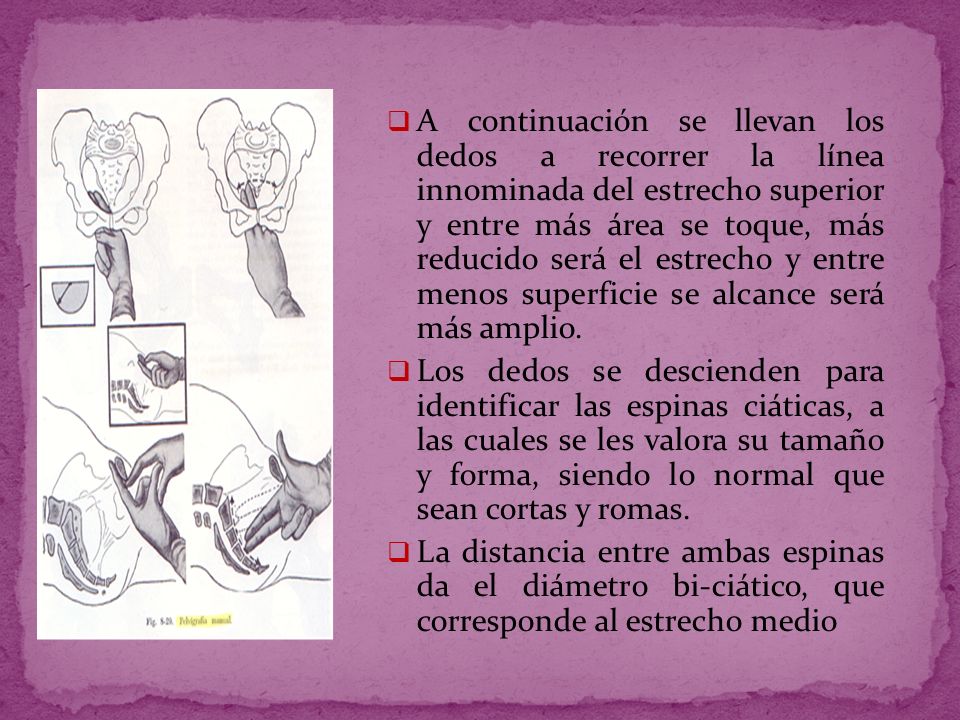 A continuación se llevan los dedos a recorrer la línea innominada del estrecho superior y entre más área se toque, más reducido será el estrecho y entre menos superficie se alcance será más amplio.