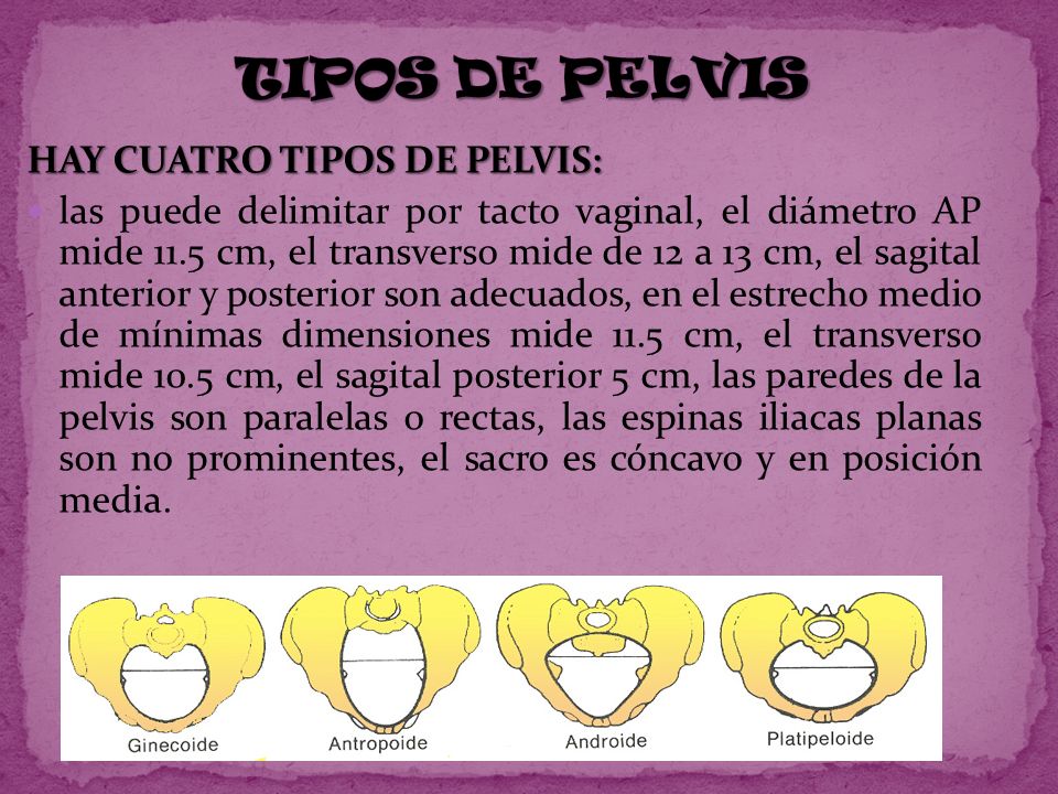 TIPOS DE PELVIS HAY CUATRO TIPOS DE PELVIS: