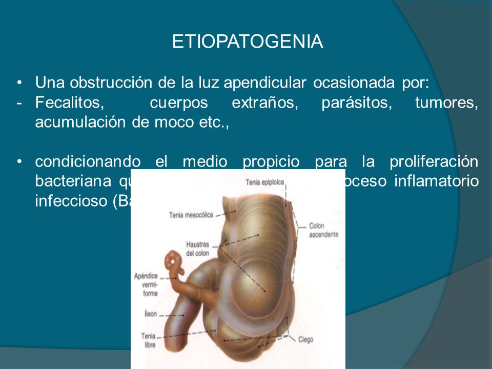 ETIOPATOGENIA Una obstrucción de la luz apendicular ocasionada por: