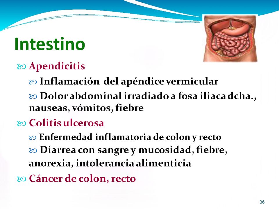 Intestino  Apendicitis  Colitis ulcerosa  Cáncer de colon, recto