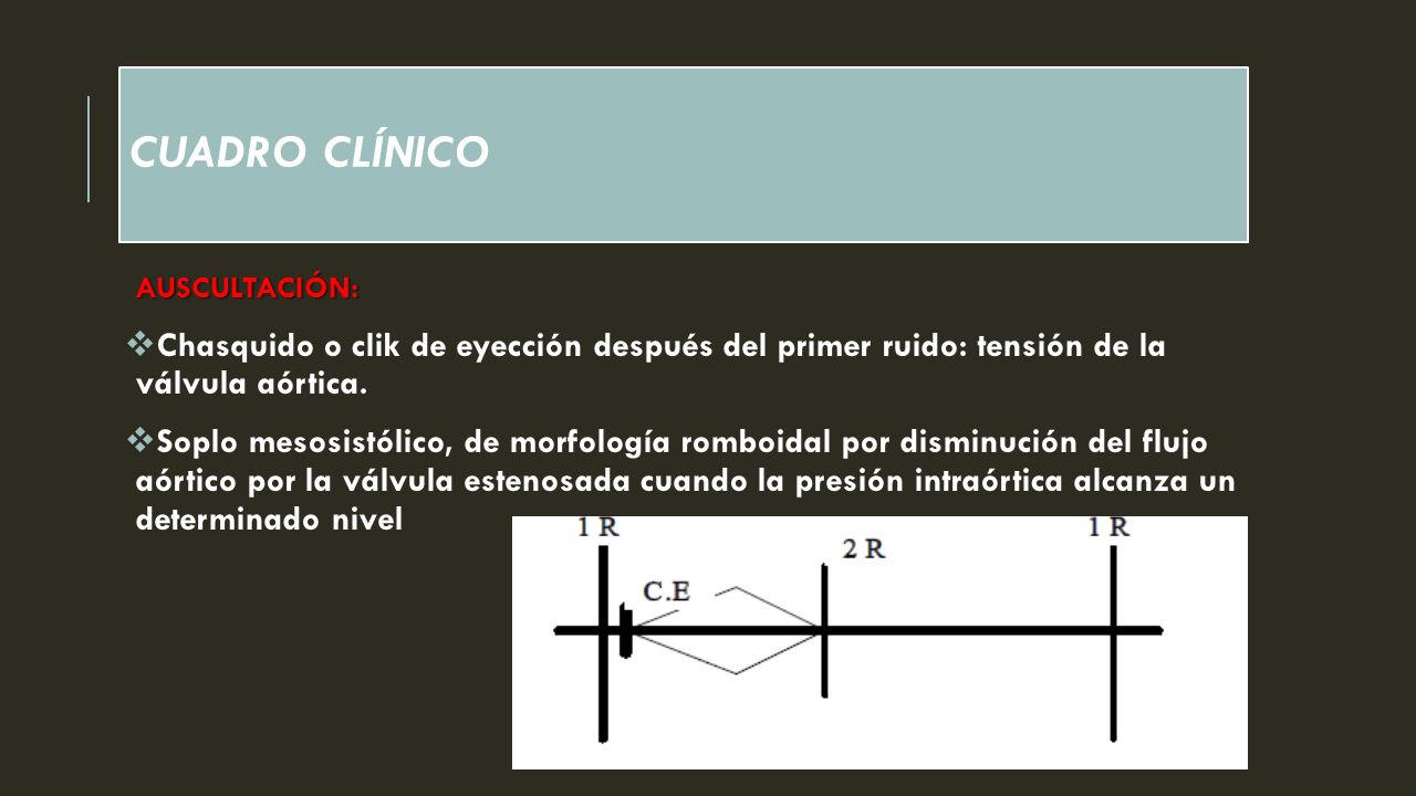 CUADRO CLÍNICO AUSCULTACIÓN: Chasquido o clik de eyección después del primer ruido: tensión de la válvula aórtica.