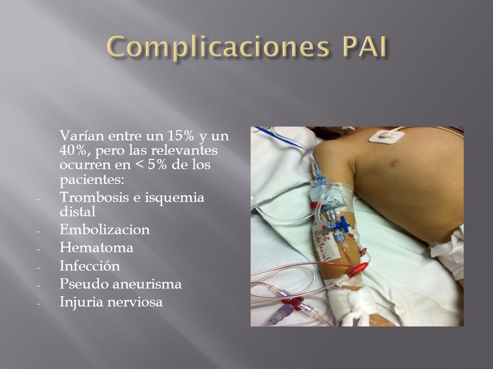Complicaciones PAI Varían entre un 15% y un 40%, pero las relevantes ocurren en < 5% de los pacientes:
